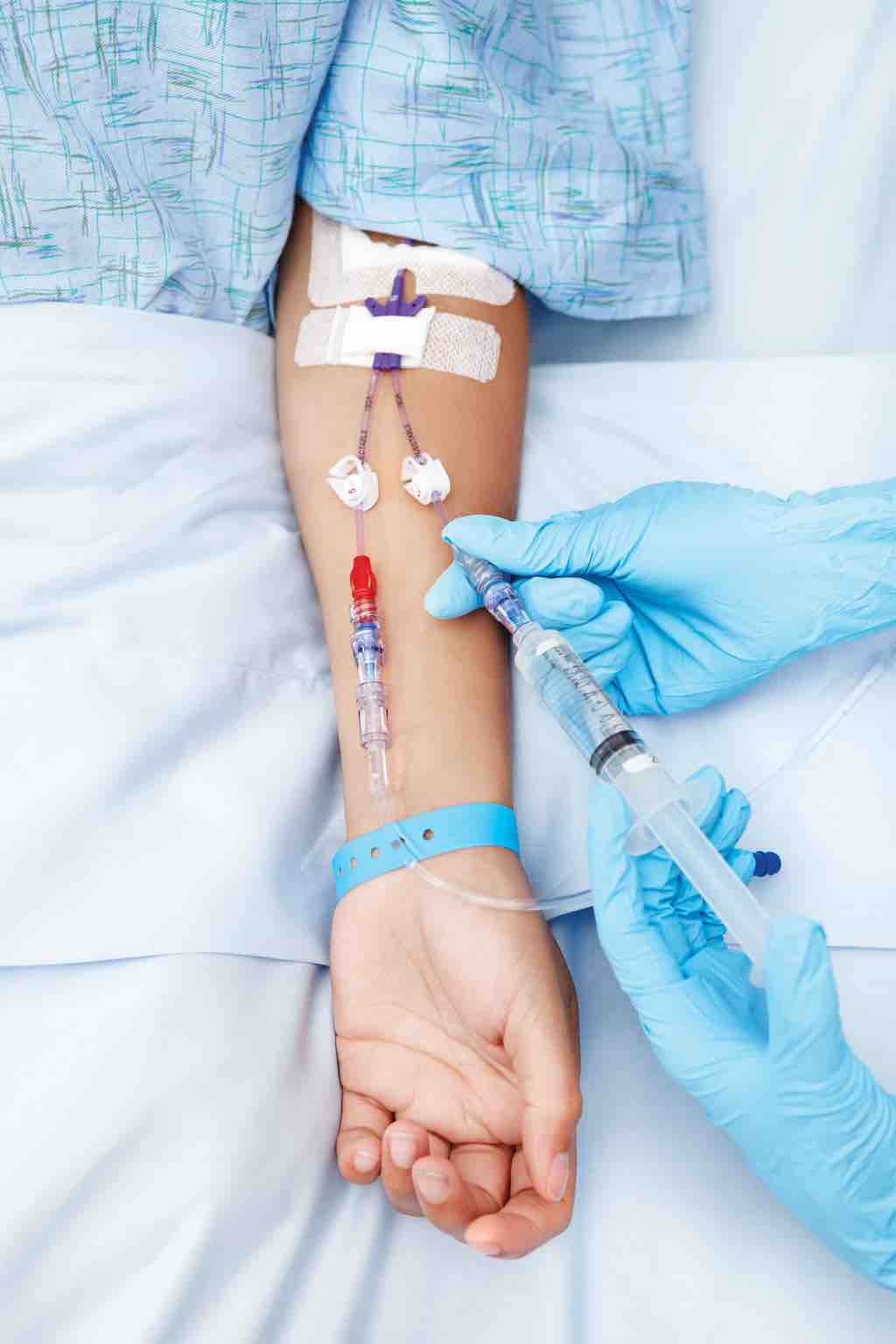 IV fluid and electrolyte administration