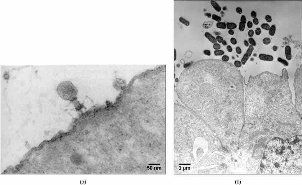 Examples of transmission electron micrographs of viruses
