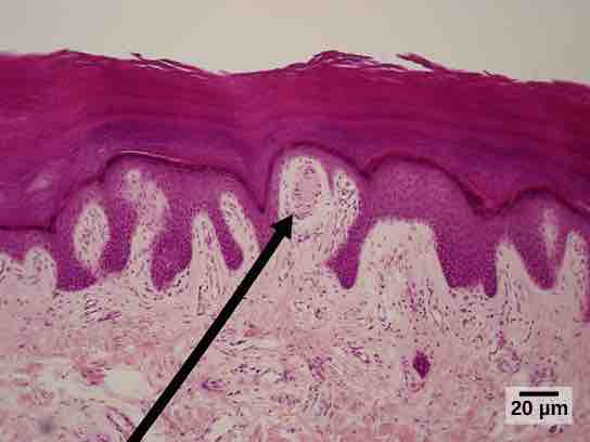 Meissner corpuscles