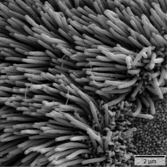 Electron microscope image of cilia
