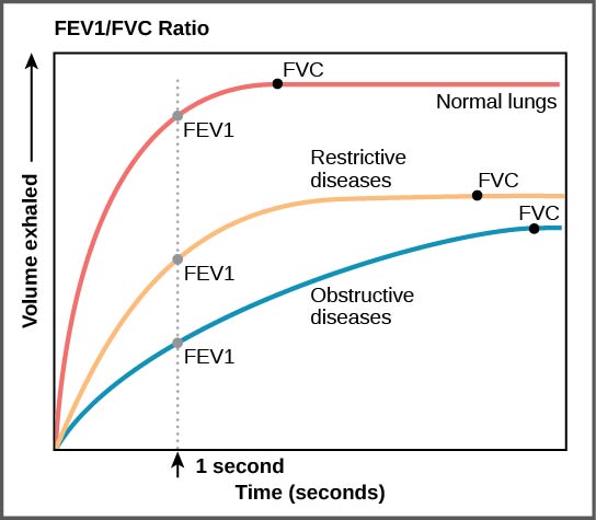 FEV1/FVC ratio