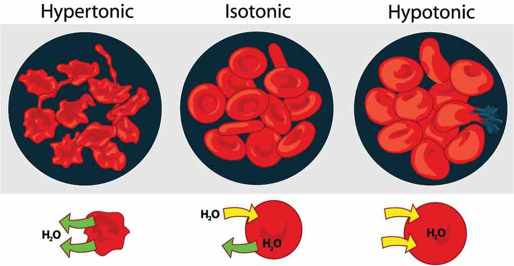 Response of red blood cells in hypertonic, hypotonic, and isotonic solutions