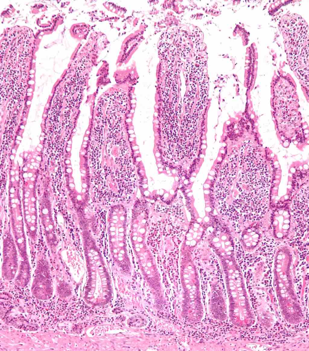 Micrograph of the small intestine