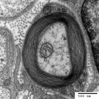 Myelinated neuron