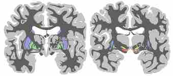 Lia coronal sections large