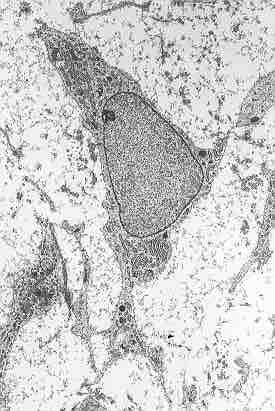 Mesenchymal stem cell