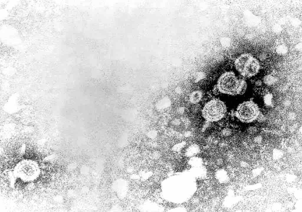 Hepatitis B Virus